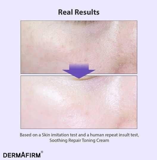 Тонизирующий крем для лица с глутатионом и бакучиолом Dermafirm Soothing Repair Toning Cream R4 50 ml 3158496650 фото