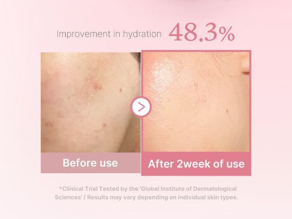 Молочный тонер с полинуклеотидами и пептидами Medicube PDRN Pink Niacinamide Milky Toner 150 ml 2789255697 фото