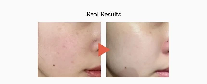 Зміцнювальна сироватка для обличчя Meditherapy Retinal Skin Booster Serum 150ml 2789286943 фото